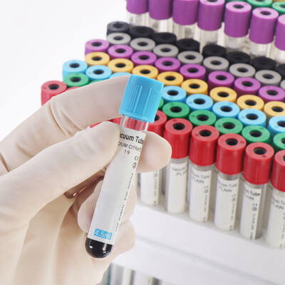 comprar Tubos de sangre EDTA con vacío para el recuento sanguíneo completo (CBC) fabricación en línea