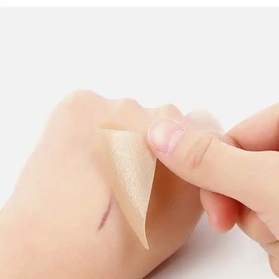 Buen precio Hojas cicatrices de silicona, cinta, tiras - Queloide curativo, cesárea, abdominoplastia - Tratamiento de cicatrices quirúrgicas en línea