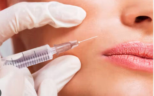 Buen precio Microagujas médicas para inyecciones cosméticas en línea